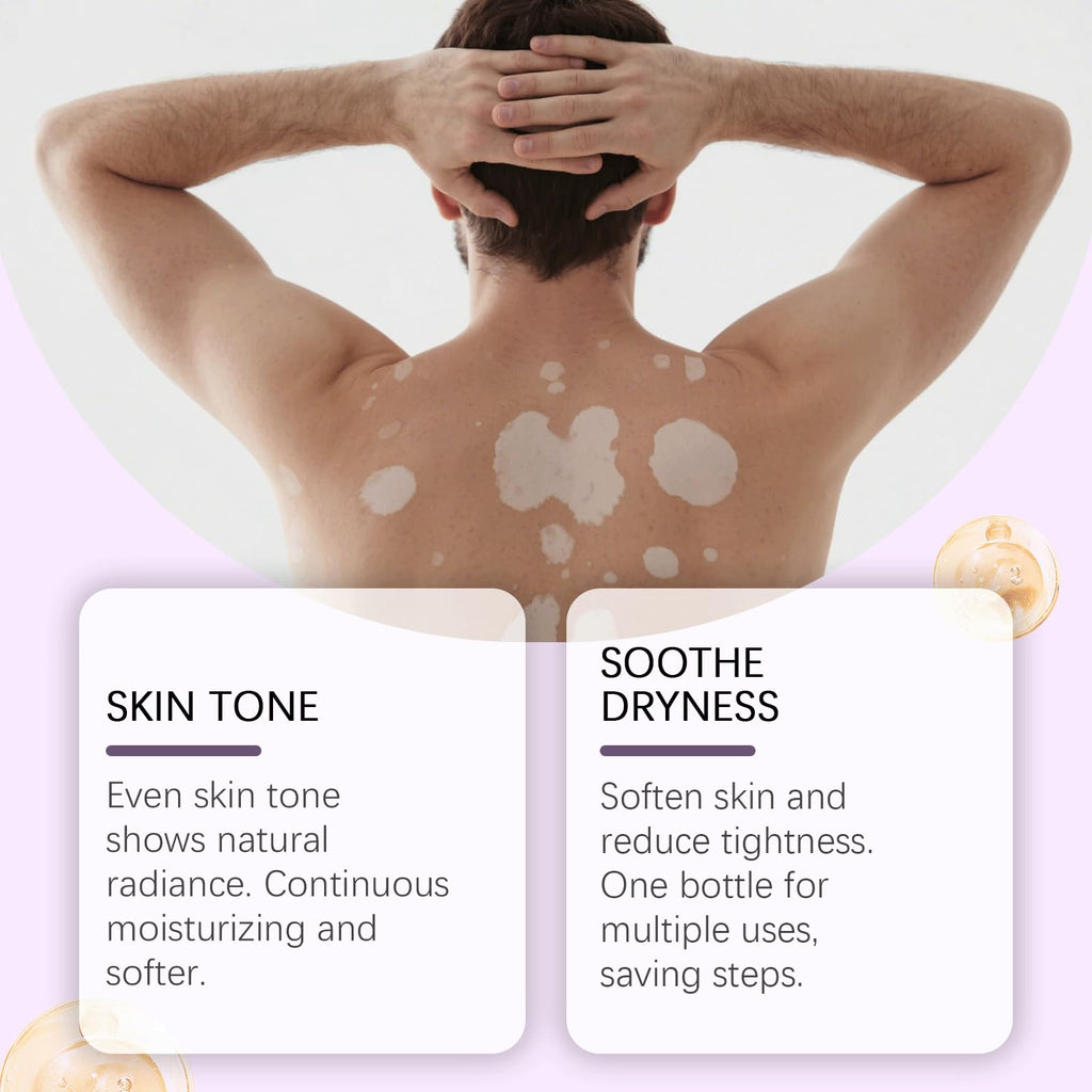 Vitiligo Cream – Natural Skin Pigmentation Support (2-Pack)