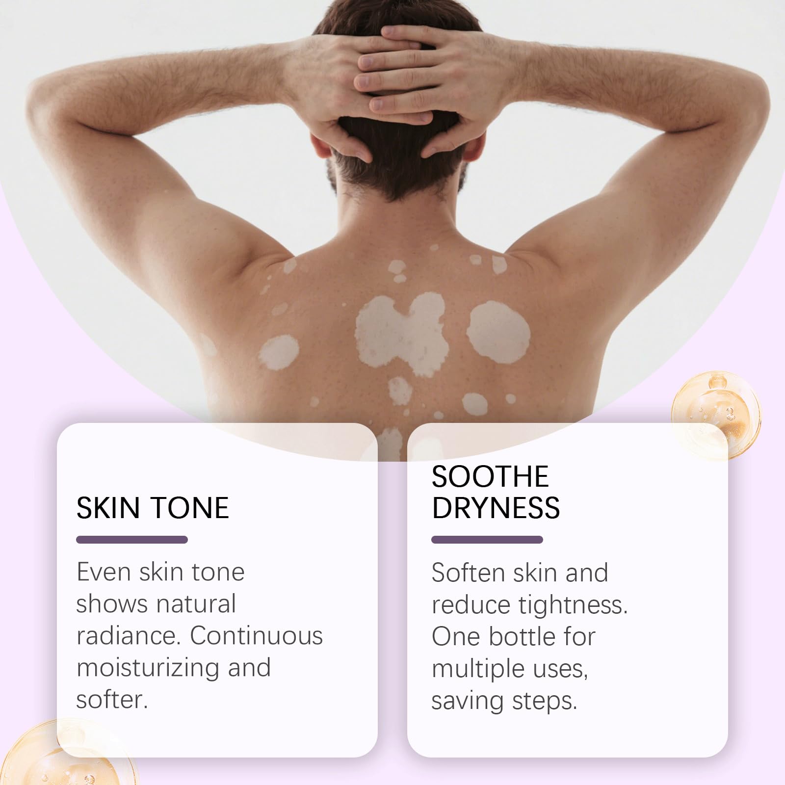 Vitiligo Cream – Natural Skin Pigmentation Support (2-Pack)
