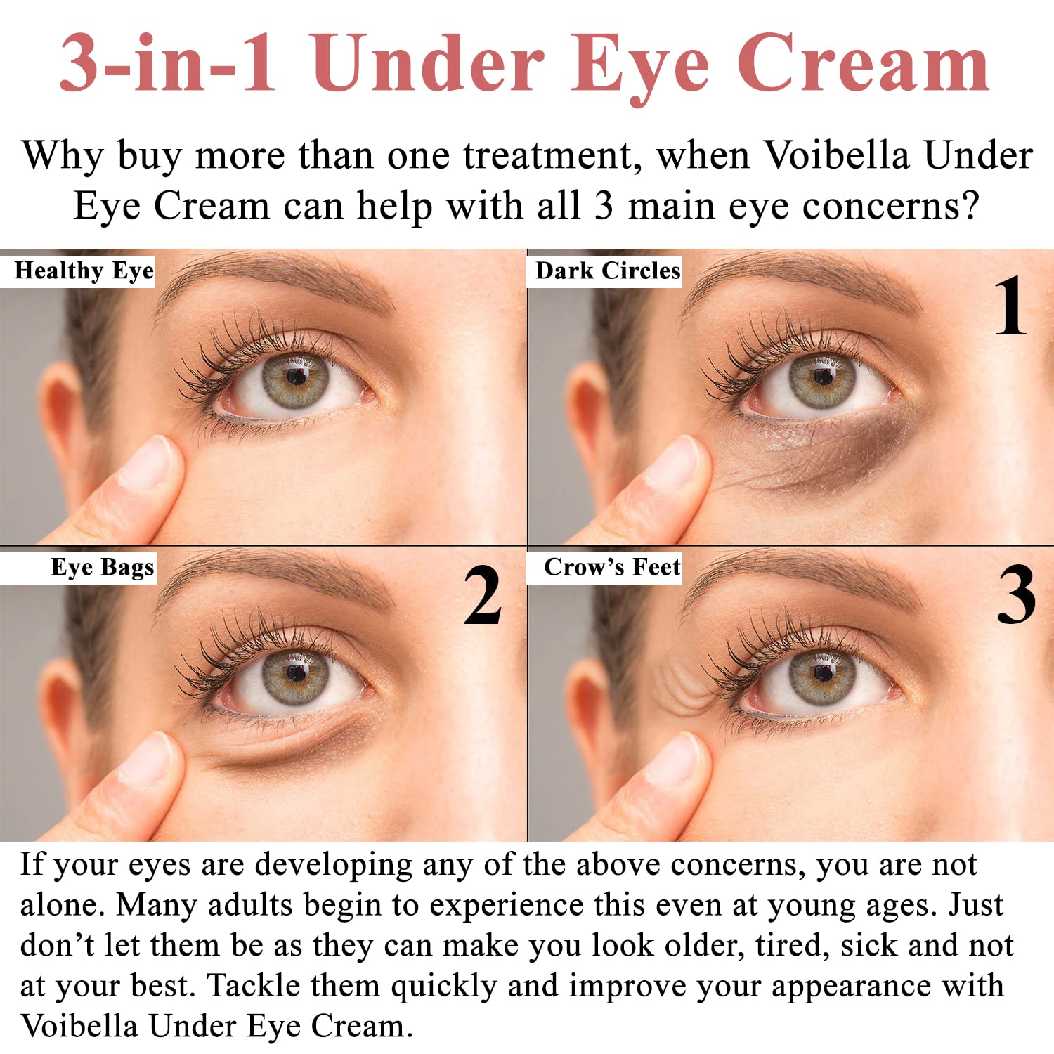 VOIBELLA BEAUTY Under Eye Cream with Retinol, Peptides, Hyaluronic Acid & Aloe — Depuff, Brighten & Hydrate
