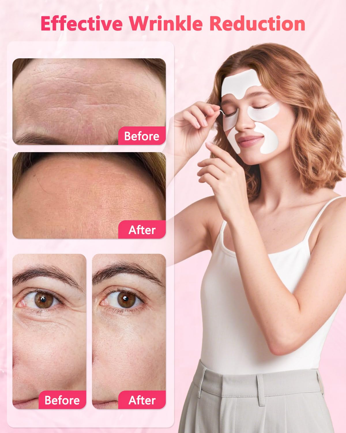 Vryioh 3-in-1 Forehead, Smile Line & Under Eye Patches – Overnight Hyaluronic Acid + Collagen