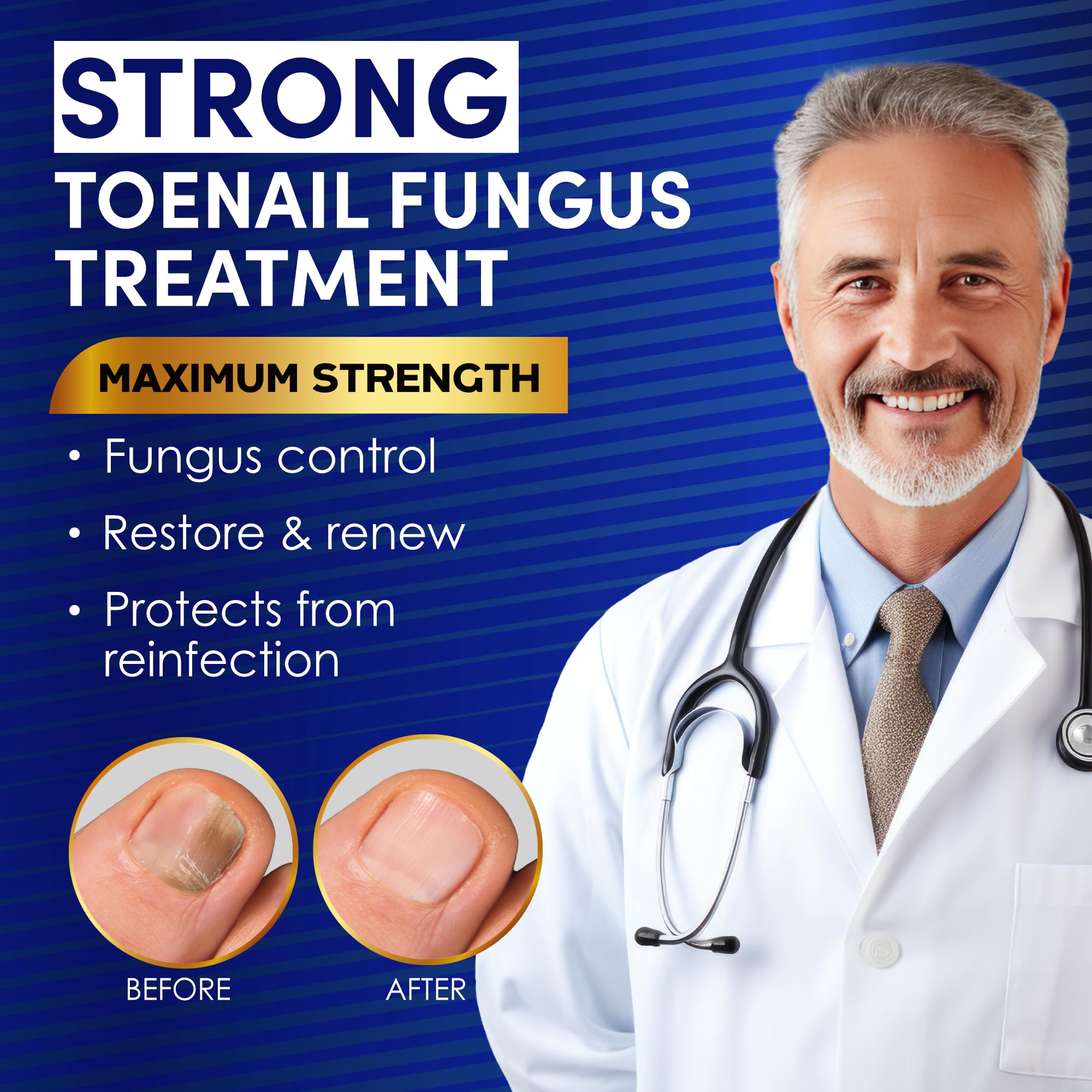 VTROUY Toenail Fungus Treatment Extra Strength – 2 Bottle Nail & Toe Solution with 25% Undecylenic Acid & Tea Tree Oil
