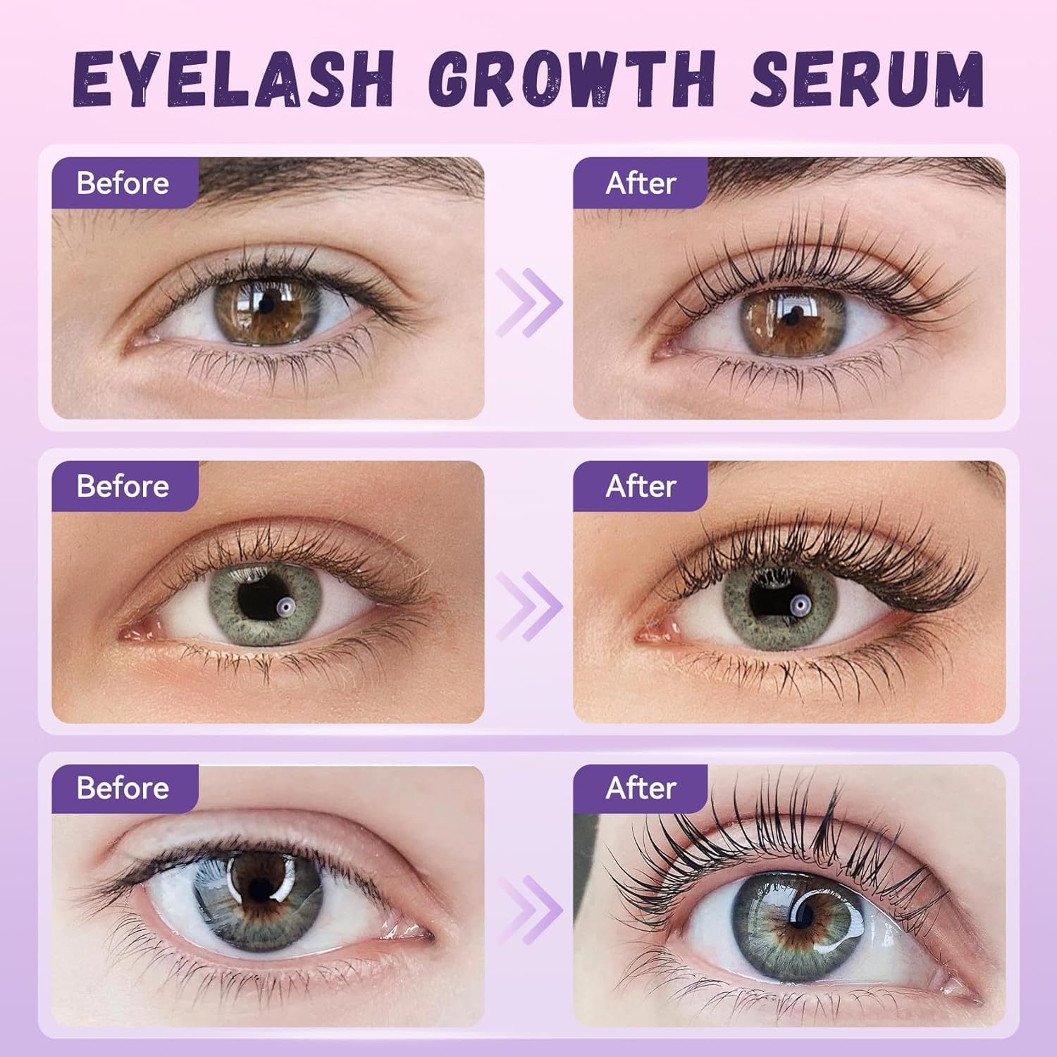 Vxzit Eyelash Growth Serum | Premium Lash Serum for Longer, Fuller Lashes (5ml)