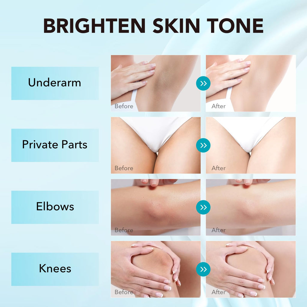 VZP Dark Spot Remover – Vitamin C Body Lightening Cream for Underarms, Elbows & More (1.7 oz)