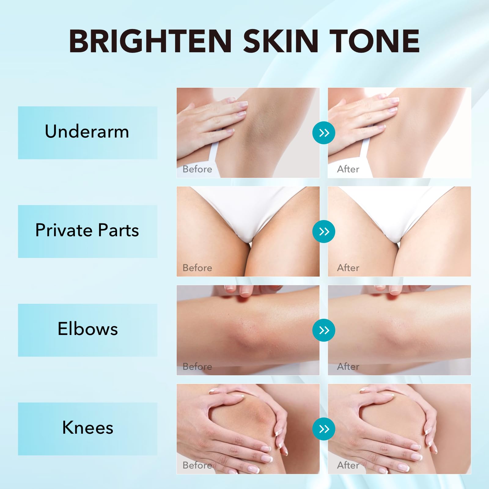 VZP Dark Spot Remover – Vitamin C Body Lightening Cream for Underarms, Elbows & More (1.7 oz)