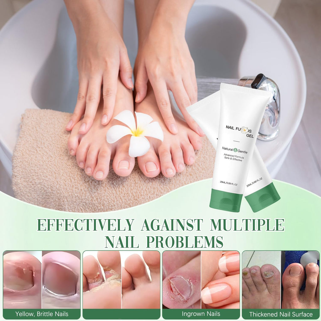 Wandyme 2PCS Natural Nail Repair Gel | Nail Growth & Foot Moisturizer