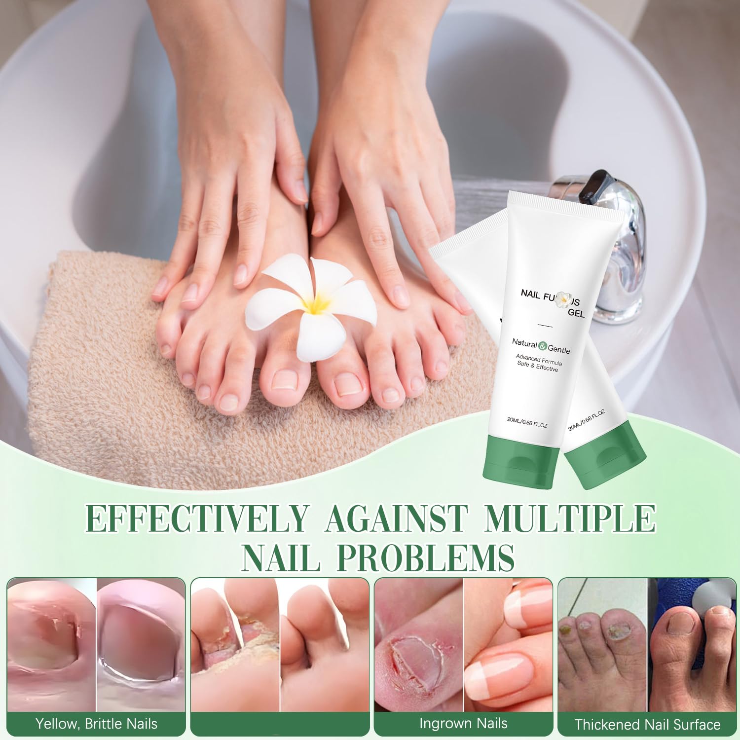 Wandyme 2PCS Natural Nail Repair Gel | Nail Growth & Foot Moisturizer