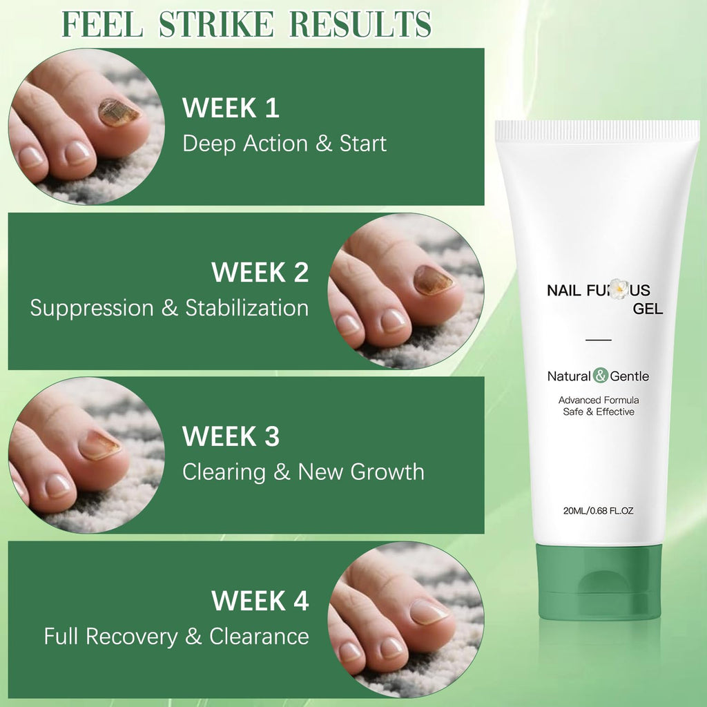 Wandyme 2PCS Natural Nail Repair Gel | Nail Growth & Foot Moisturizer