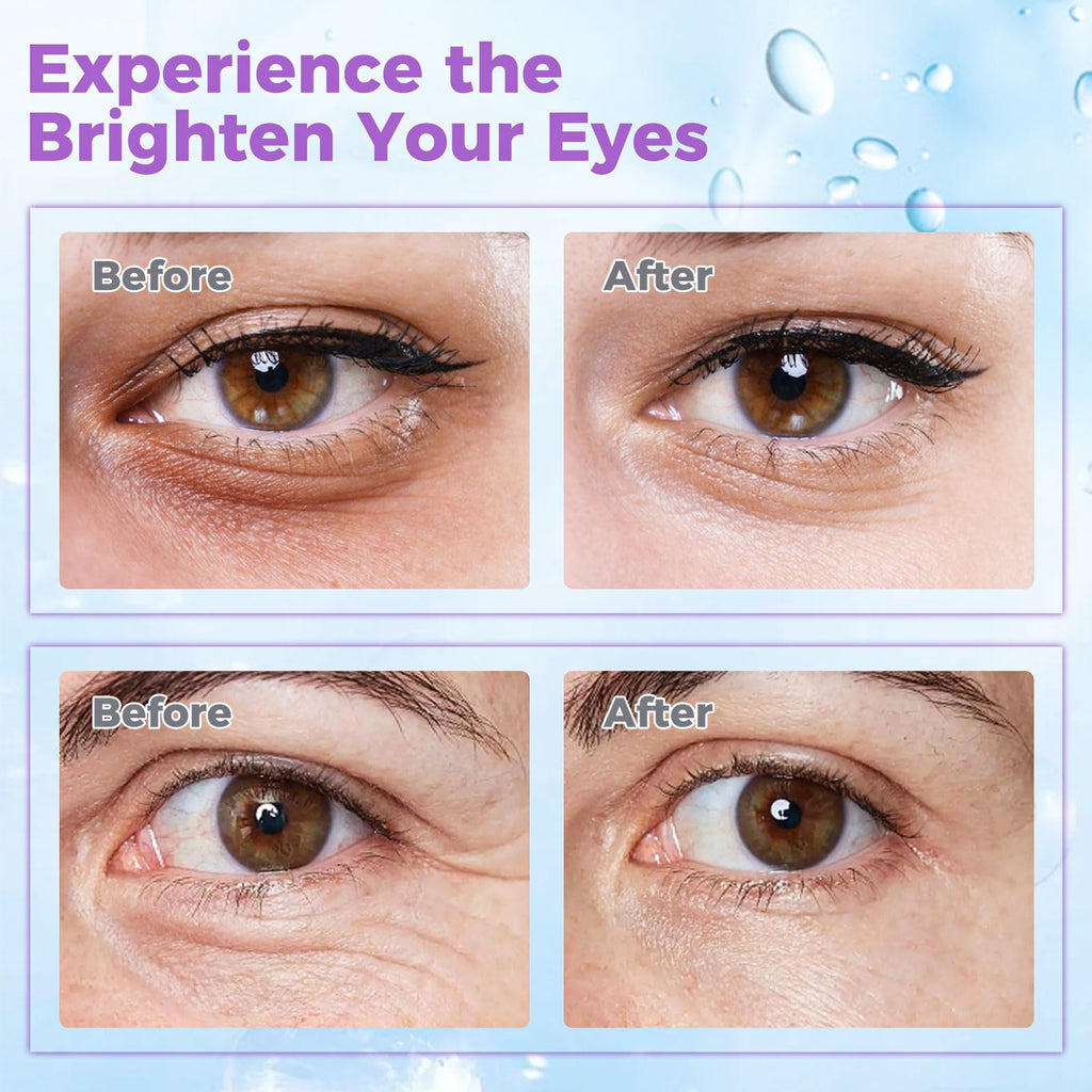 WEAUUP Eye Cream for Dark Circles & Puffiness – Retinol, Hyaluronic Acid, Caffeine & Peptides
