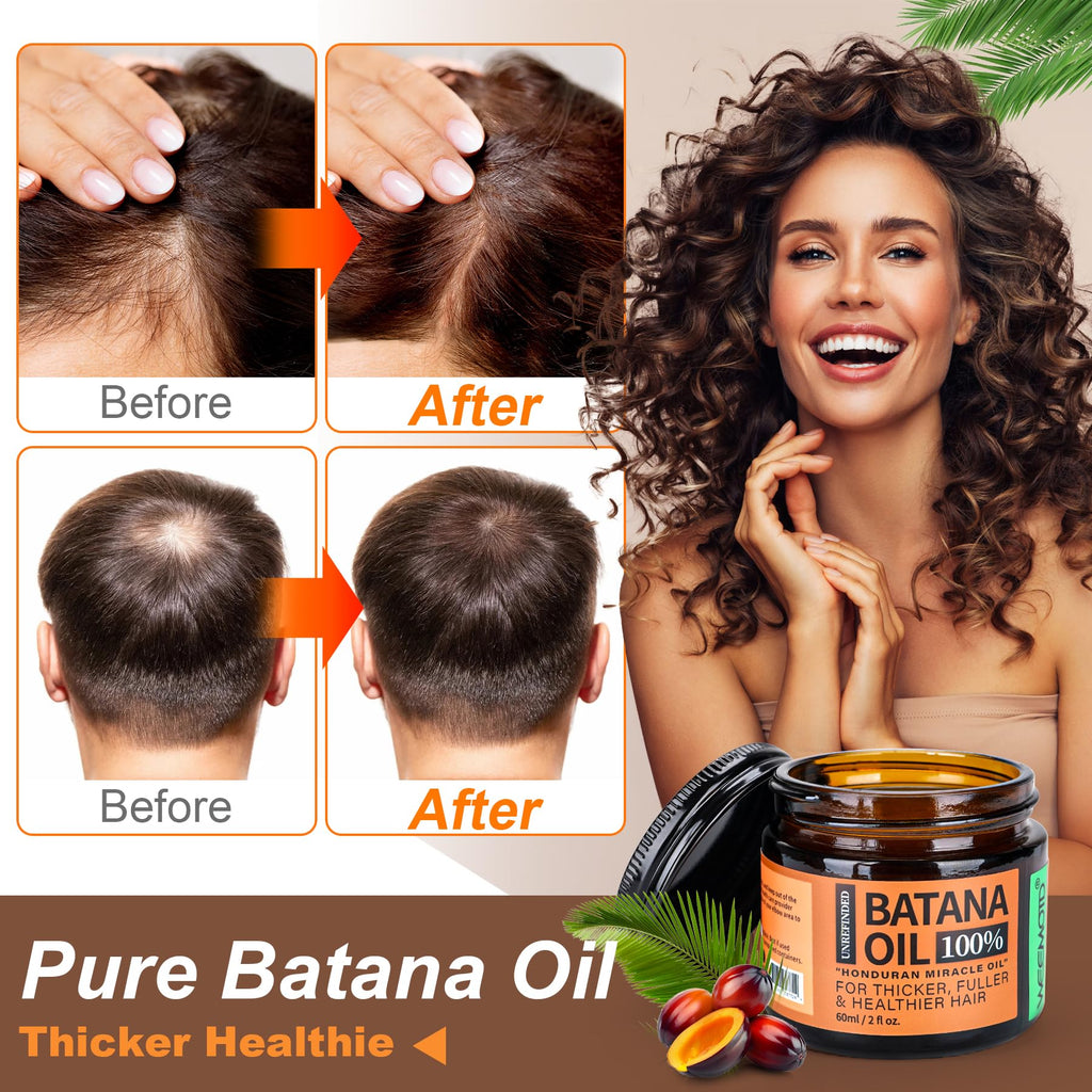 WEEMOTD Unrefined Batana Oil for Hair Growth – Honduran Raw Batana Oil (2 oz, Espresso Coffee)