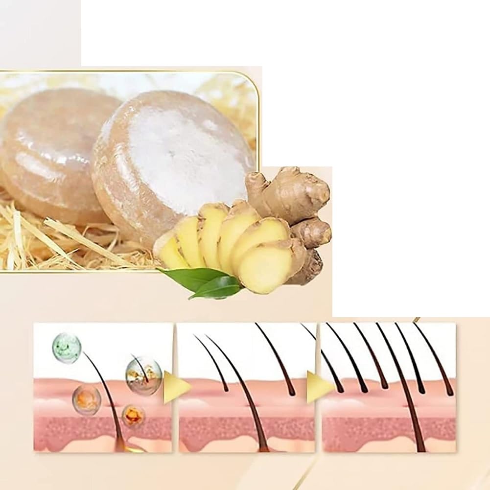 WenFeng Ginger Shampoo Bar – 2 Pcs Natural Hair Growth for Men & Women