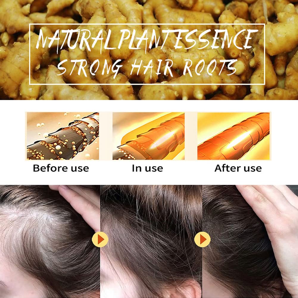 WenFeng Ginger Shampoo Bar – 2 Pcs Natural Hair Growth for Men & Women