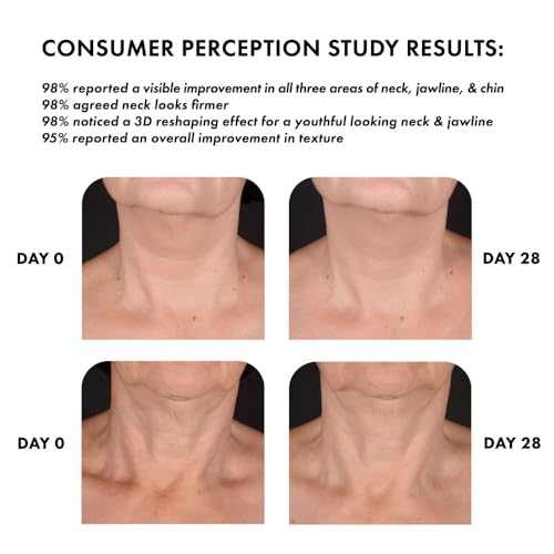 Whish Neck Firming Cream with Bakuchiol – 3D Neck Reshaping (3.4oz)