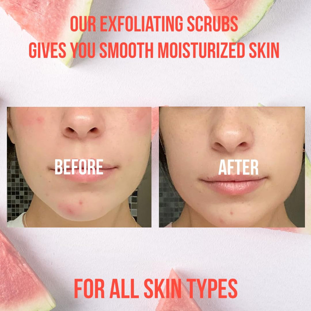 White Naturals Organic Pink Watermelon Body Scrub – Gentle Exfoliation & Hydration