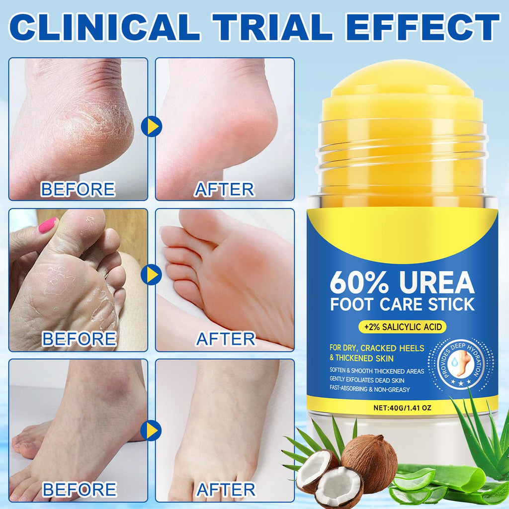 WHLH & WELL-BEING 60% Urea Foot Cream Stick with 2% Salicylic Acid – 2 Pack