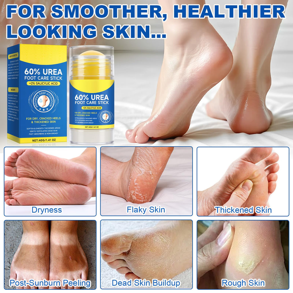 WHLH & WELL-BEING 60% Urea Foot Cream Stick with 2% Salicylic Acid – 2 Pack