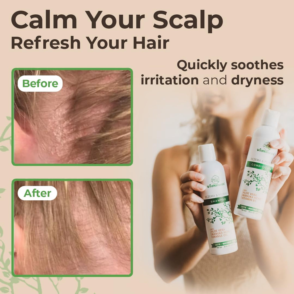 Wild Naturals Eczema & Psoriasis Shampoo Set for Dry, Itchy Scalp | Dandruff & Seborrheic Dermatitis Care