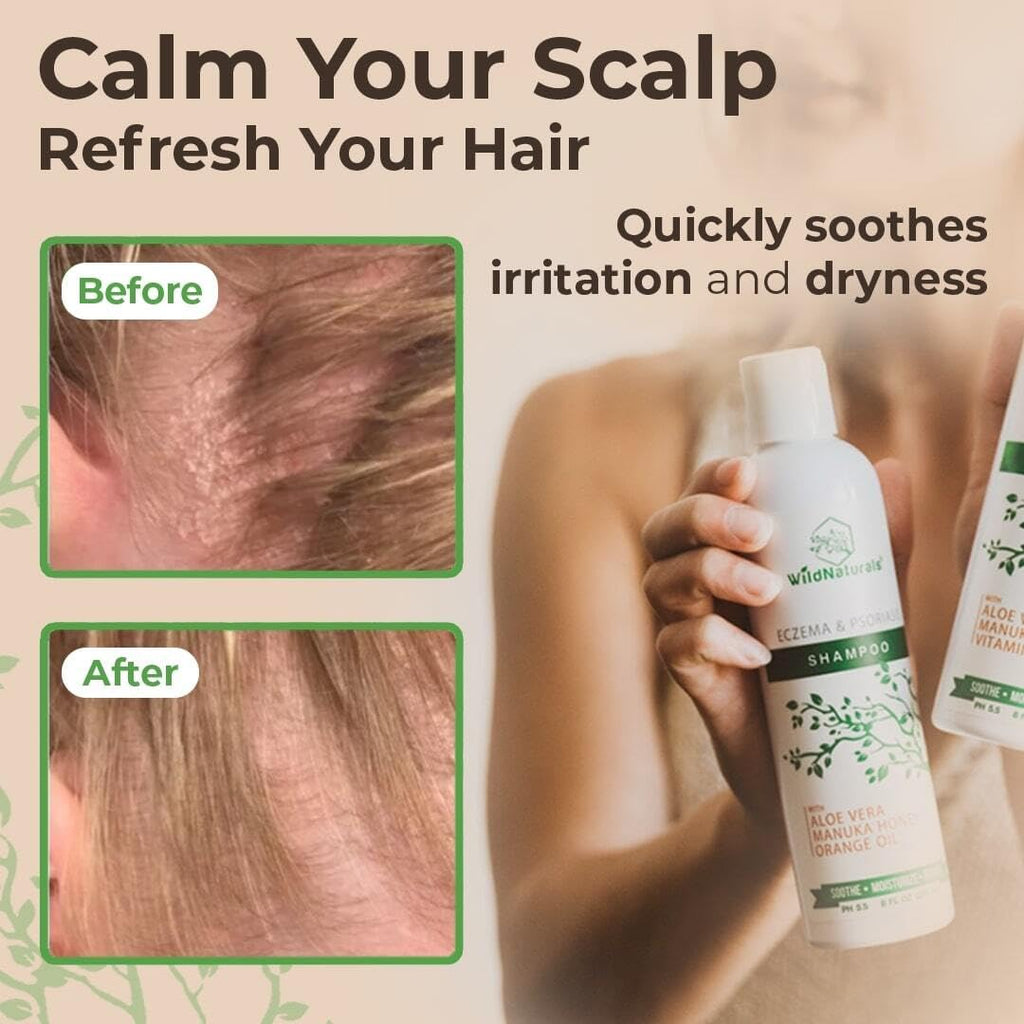 Wild Naturals Eczema & Psoriasis Shampoo – Hypoallergenic, Fragrance-Free Scalp Relief | pH 5.5