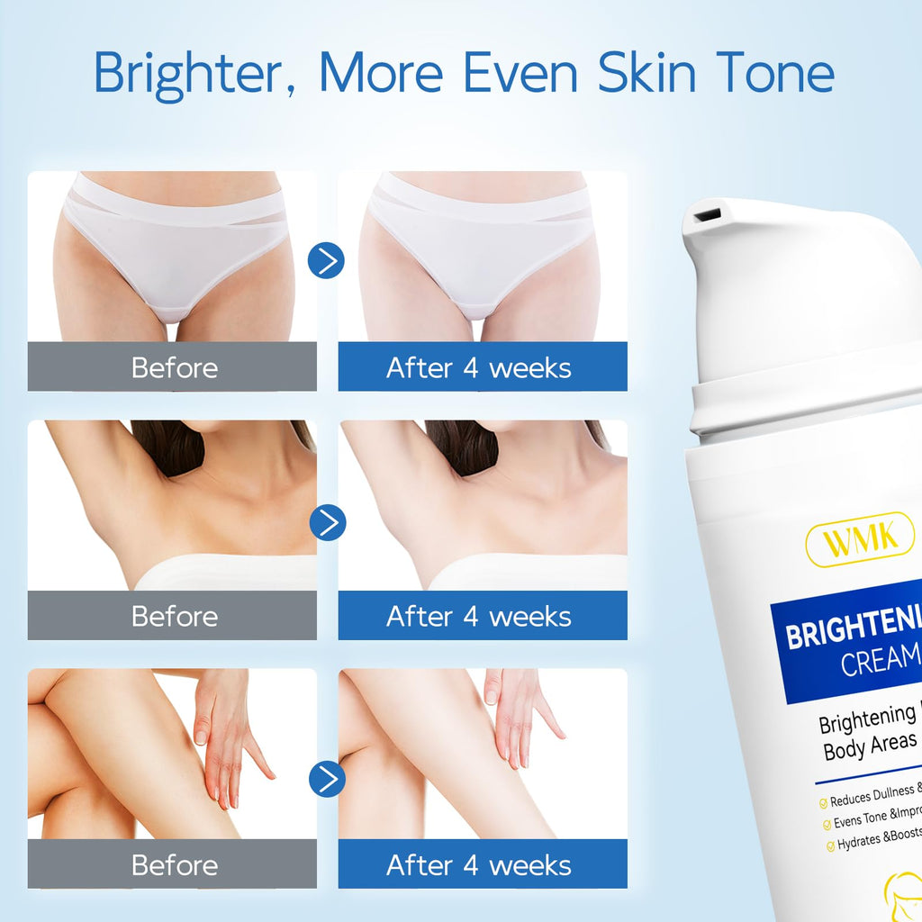 WMK Skin Brightening Cream for Intimate Areas – Vitamin C Dark Spot Remover for Underarms, Knees, Elbows & Bikini Line