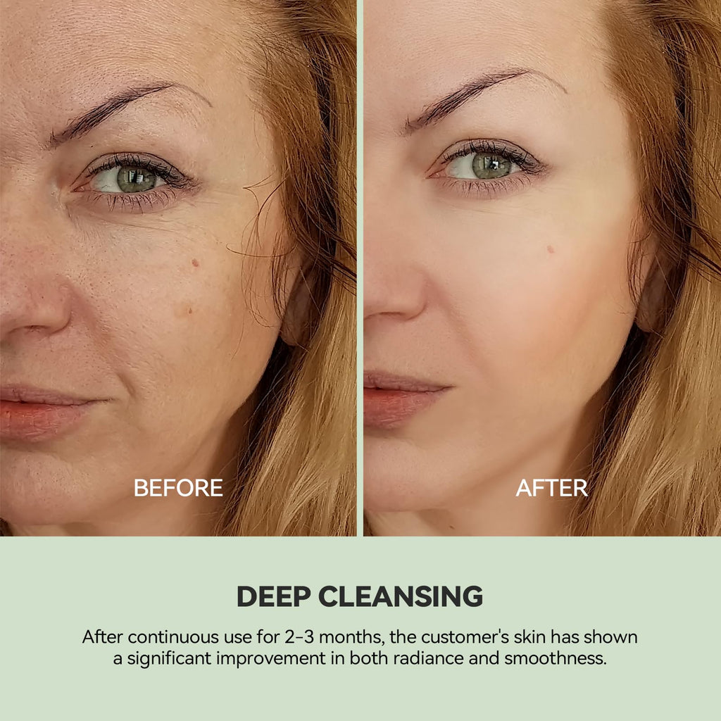 WNP Duo Cleansing Clay Mask – Niacinamide & Hyaluronic Acid for Deep Pore Cleansing (3.53 oz)