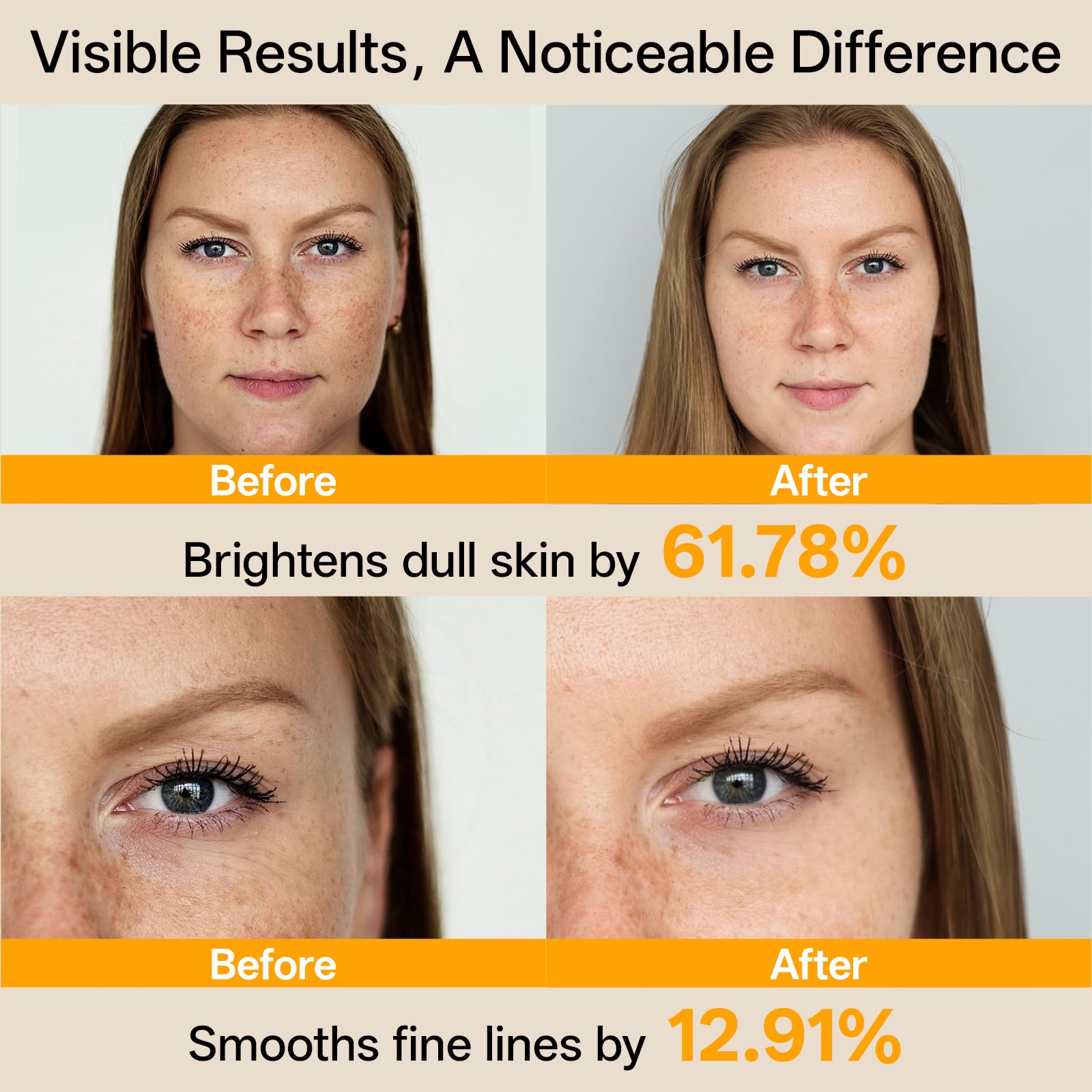 WNP Vitamin C Serum for Face – Dermatologist Tested Brightening Serum with Hyaluronic Acid & Vitamin E