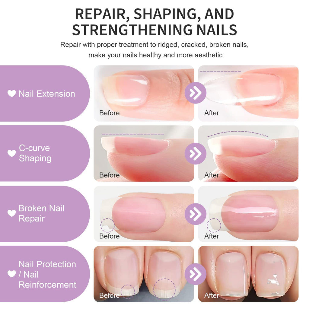 X&D Poly Gel Nail Kit: 5 Colors, Dual Forms, Brush & File Set