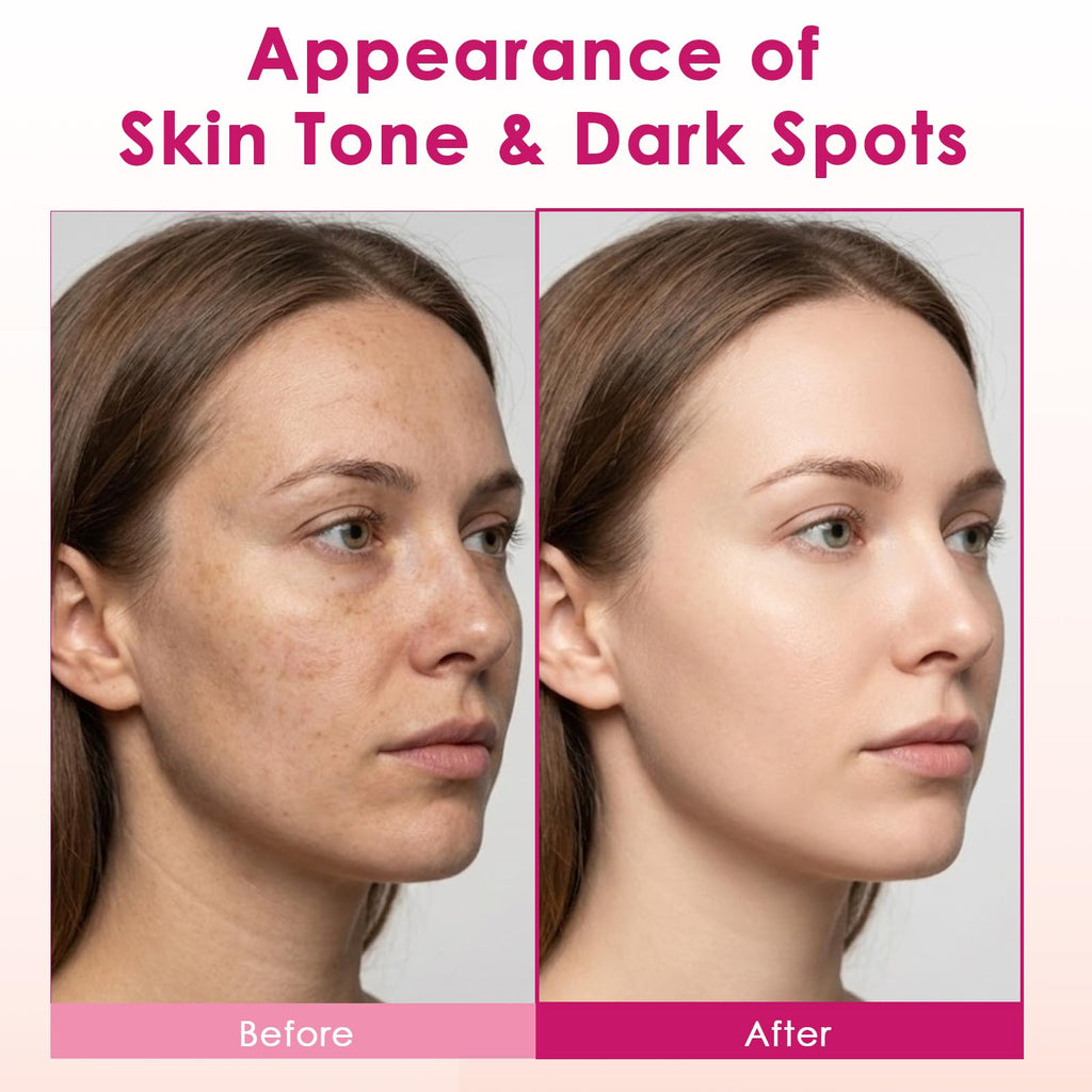 XILRVON Arbutin 7% + Tranexamic Acid 4% Cream with Niacinamide 1% – Dark Spots & Uneven Skin Tone, 1.76 oz