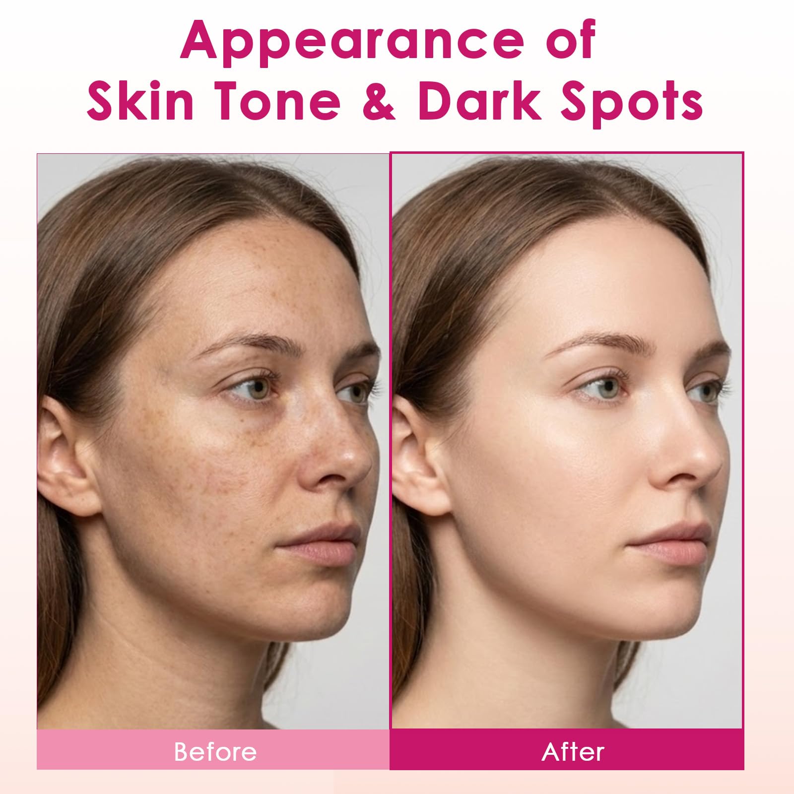 XILRVON Arbutin 7% + Tranexamic Acid 4% Cream with Niacinamide 1% – Dark Spots & Uneven Skin Tone, 1.76 oz