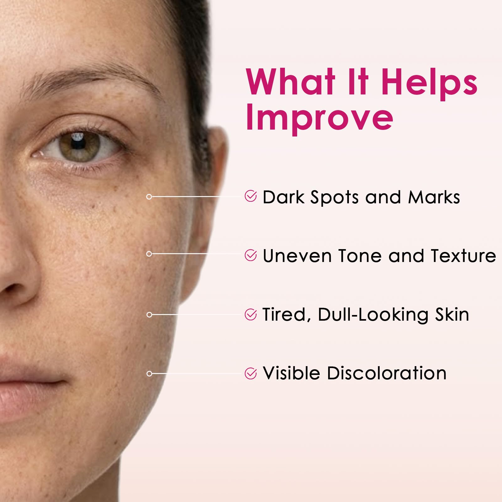 XILRVON Arbutin 7% + Tranexamic Acid 4% Cream with Niacinamide 1% – Dark Spots & Uneven Skin Tone, 1.76 oz