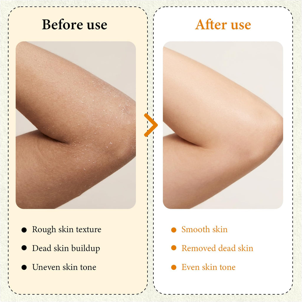 XILRVON Kojic Acid Turmeric Body Spray with Sponge – Exfoliating Mist with Retinol, Niacinamide, Glutathione – 100ml