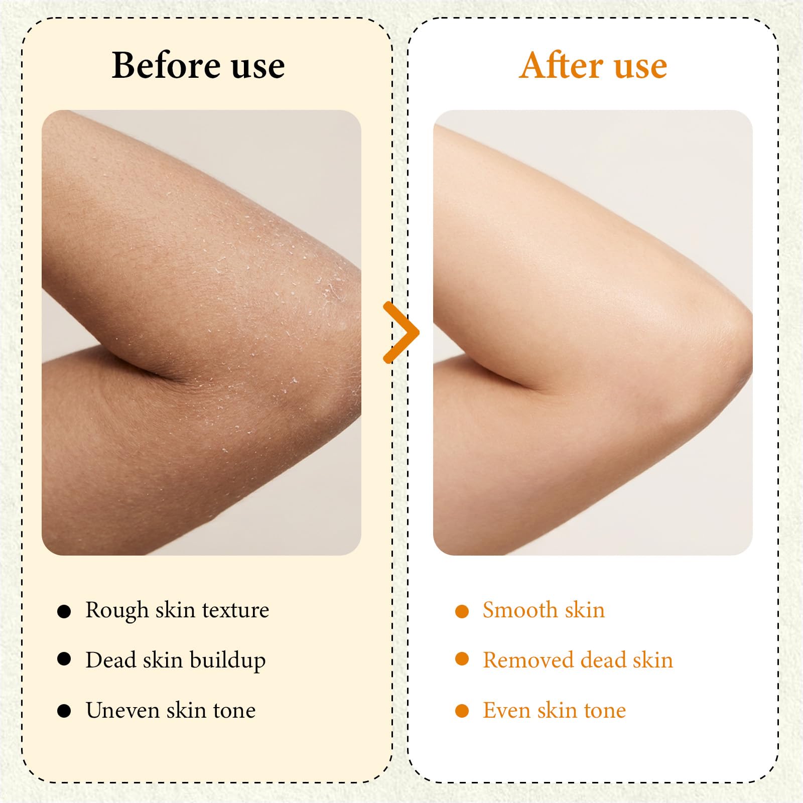 XILRVON Kojic Acid Turmeric Body Spray with Sponge – Exfoliating Mist with Retinol, Niacinamide, Glutathione – 100ml