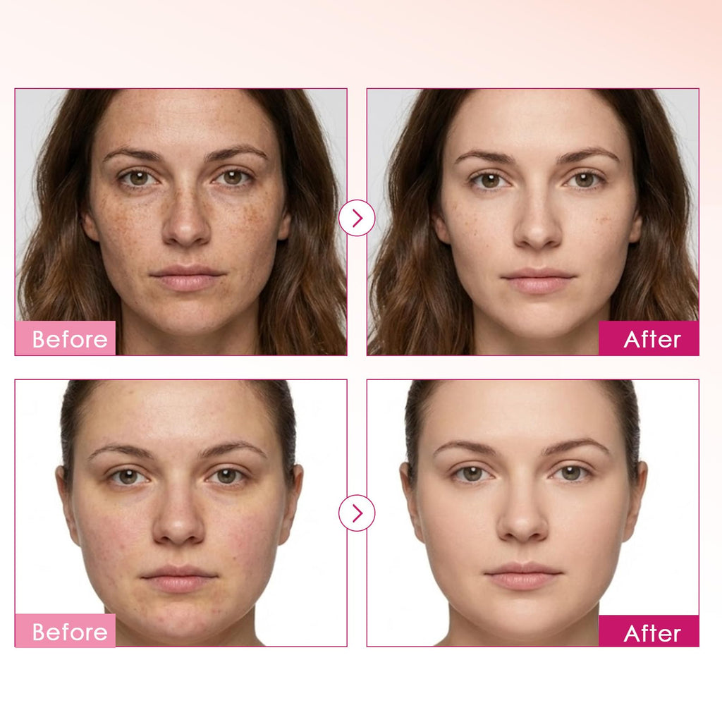 XILRVON Arbutin 7% + Tranexamic Acid 4% Cream with Niacinamide 1% – Dark Spots & Uneven Skin Tone, 1.76 oz