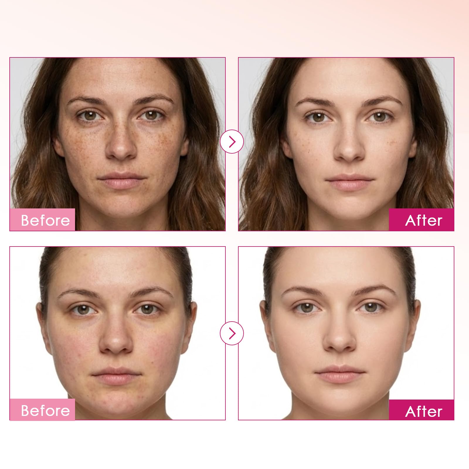 XILRVON Arbutin 7% + Tranexamic Acid 4% Cream with Niacinamide 1% – Dark Spots & Uneven Skin Tone, 1.76 oz