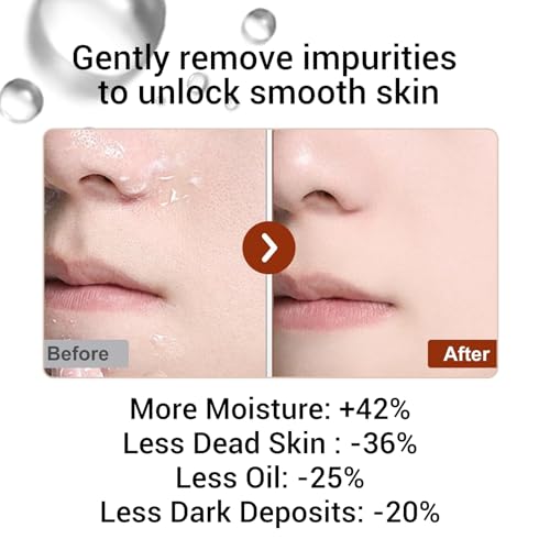 XOTMPFLY Black Rice Exfoliating Peel Shot – Gentle Facial Exfoliator