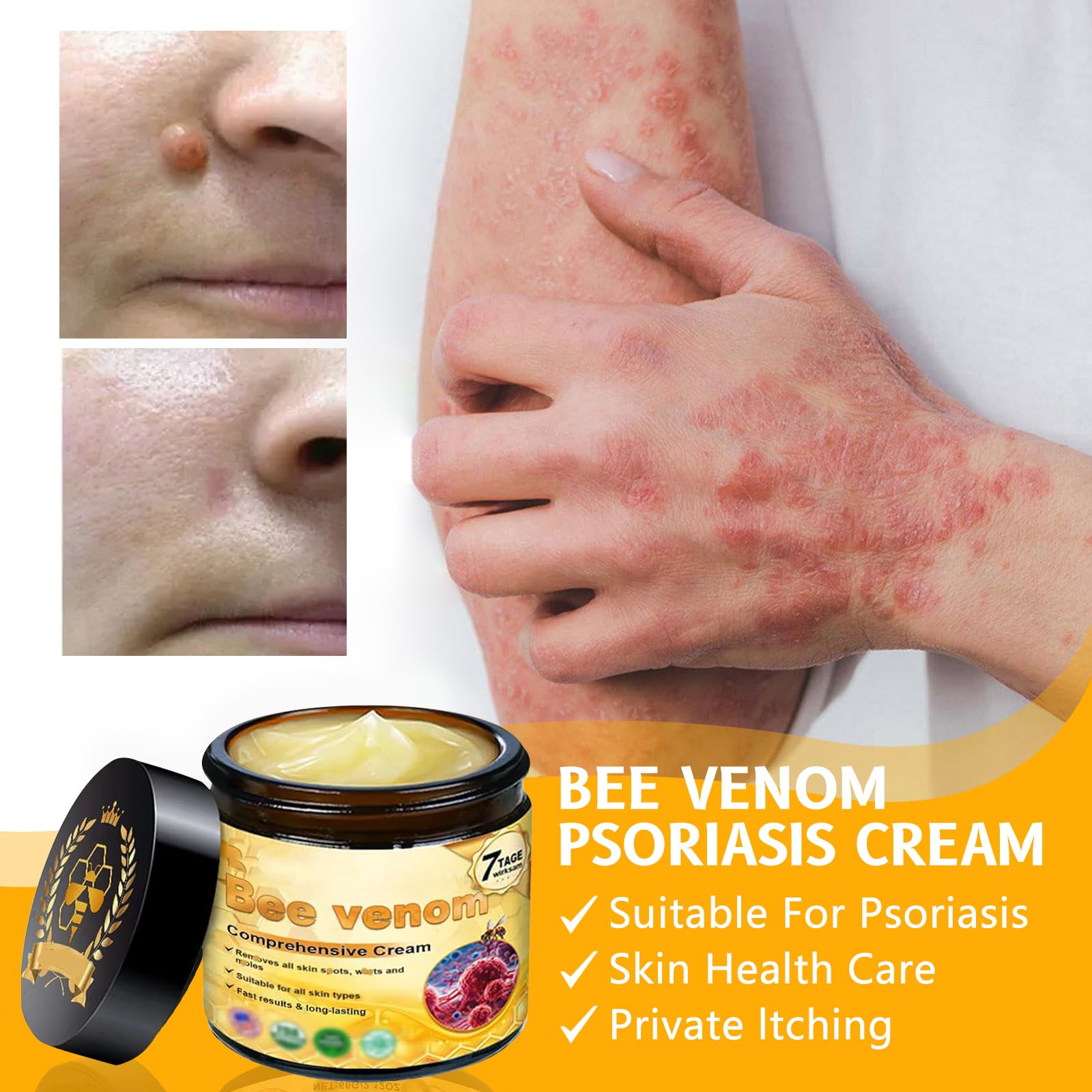 YAGUAN Bee Venom Cream – Natural Anti-Aging Skin Treatment for Sensitive Skin (1 PCS)