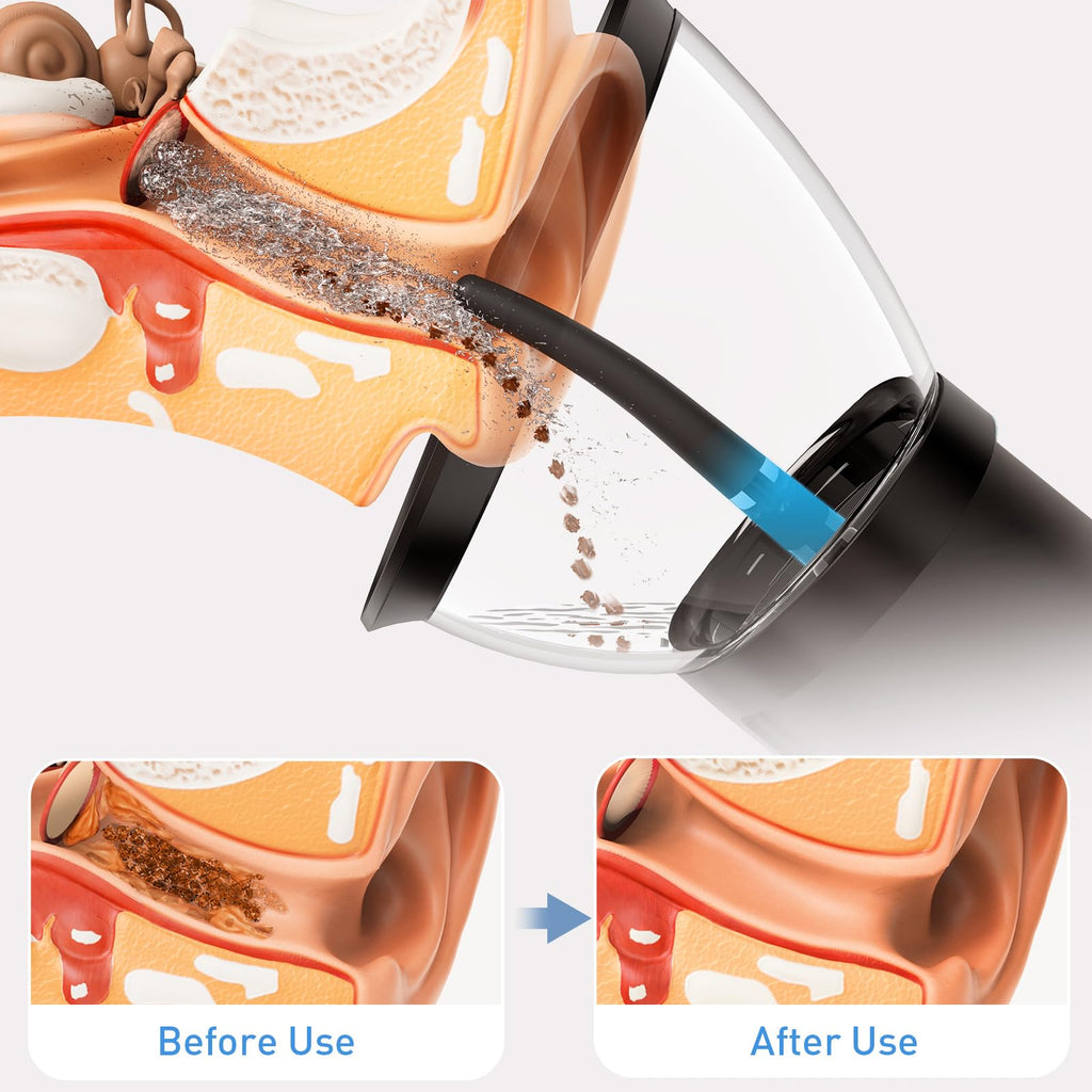 Yakbio Ear Wax Cleaner - Electric Ear Washer with 4 Pressure Modes, Retractable & Waterproof