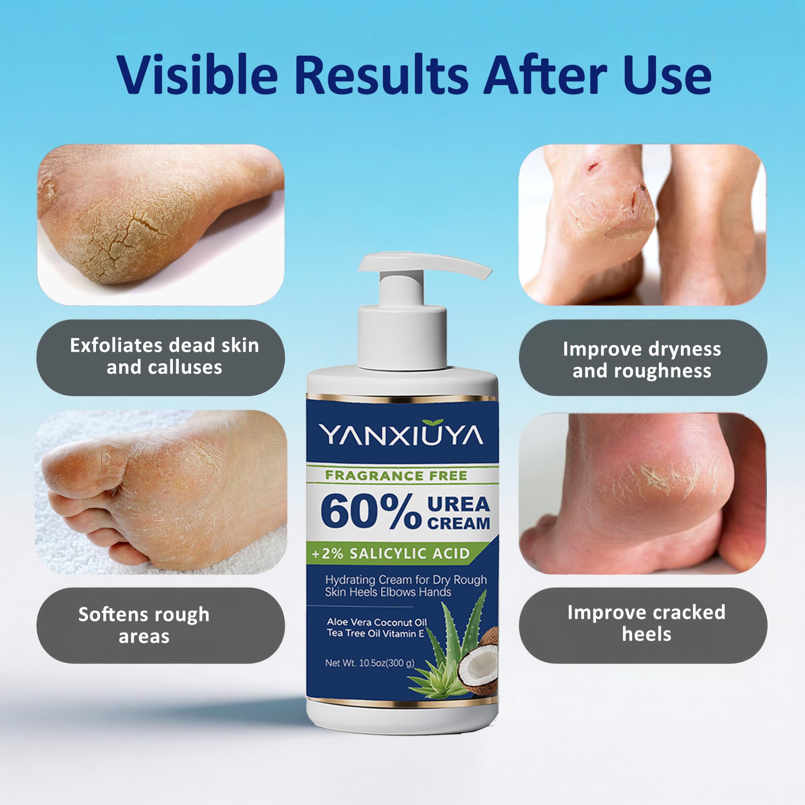 YANXIUYA 60% Urea Cream – 10.5 oz Fragrance-Free Foot Moisturizer with 2% Salicylic Acid