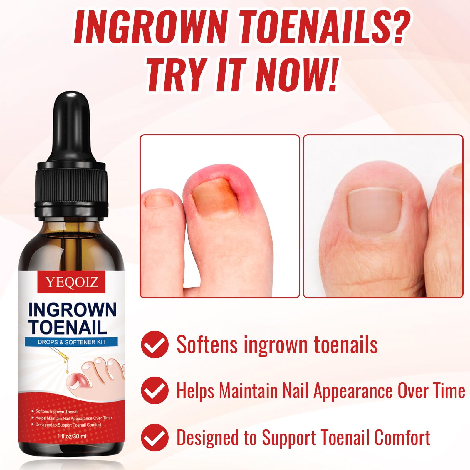 YEQOIZ Ingrown Toenail Removal Kit — All-In-One Home Care Tools