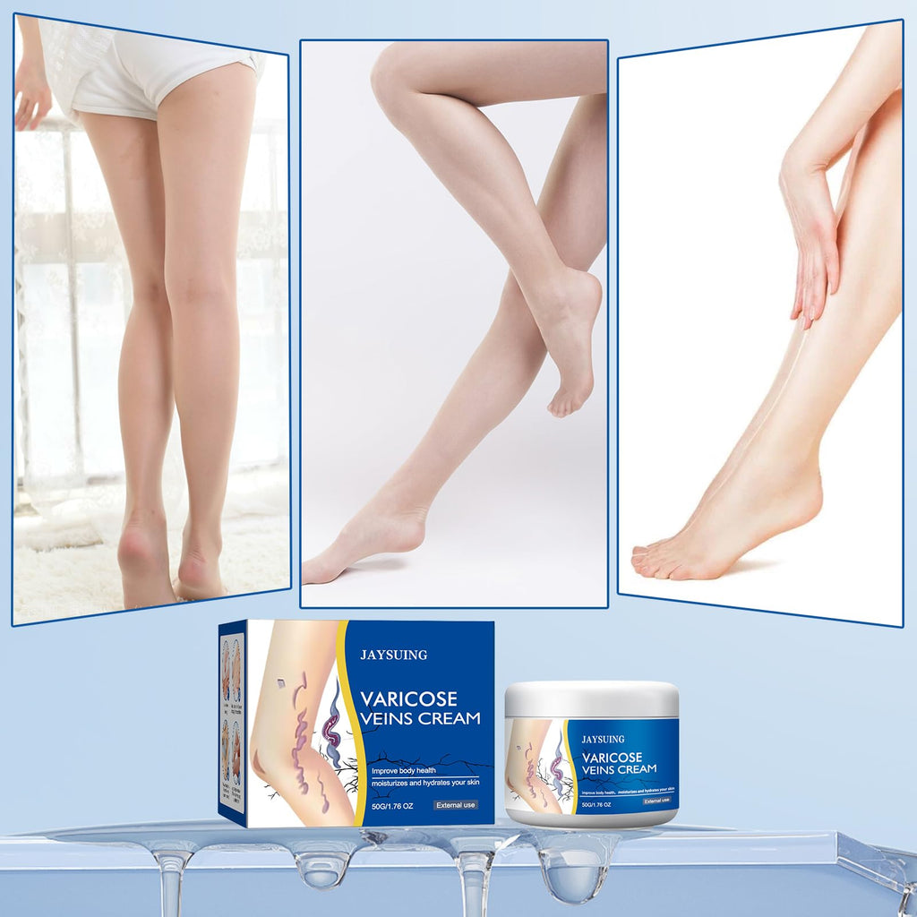 yetary Varicose Veins Cream for Legs – 2-Pack, Gentle Hydration & Care