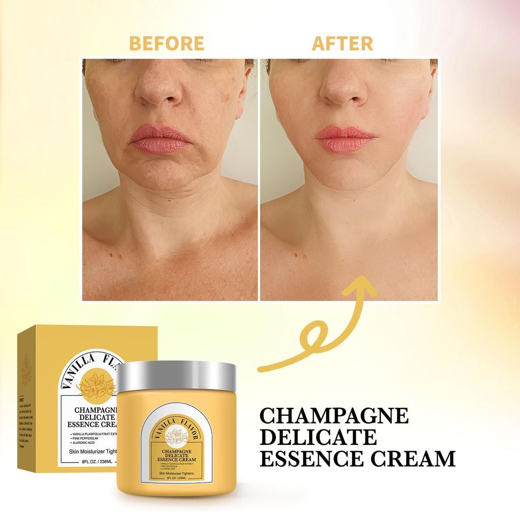 YILEST Champagne Lift Body Cream – Hydrating & Firming for Face & Body | 8 oz Vanilla