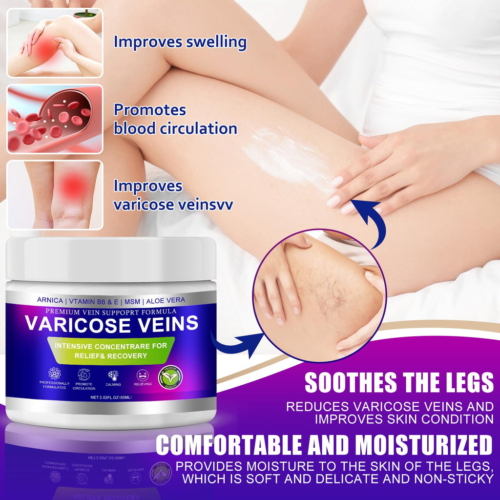 Yongsenina Varicose Veins Cream for Legs – Lightweight, Non-Sticky Vein & Spider Vein Treatment