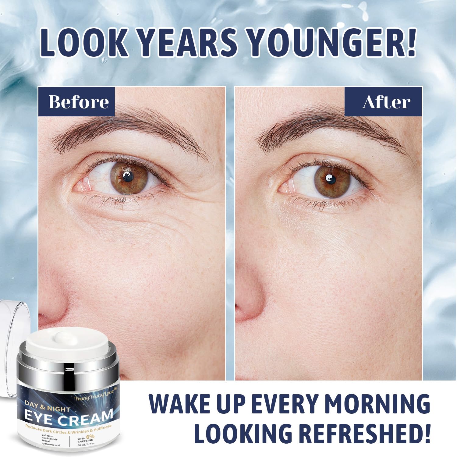 YOUNGYOUNGLOVE Day & Night Eye Cream - 6% Caffeine, Retinol, Niacinamide, Collagen