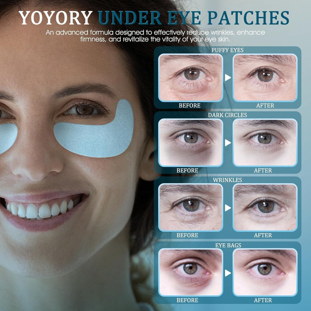 YOYORY Under Eye Patches Masks — Hydrating Hyaluronic Acid & Collagen (30 Pcs)
