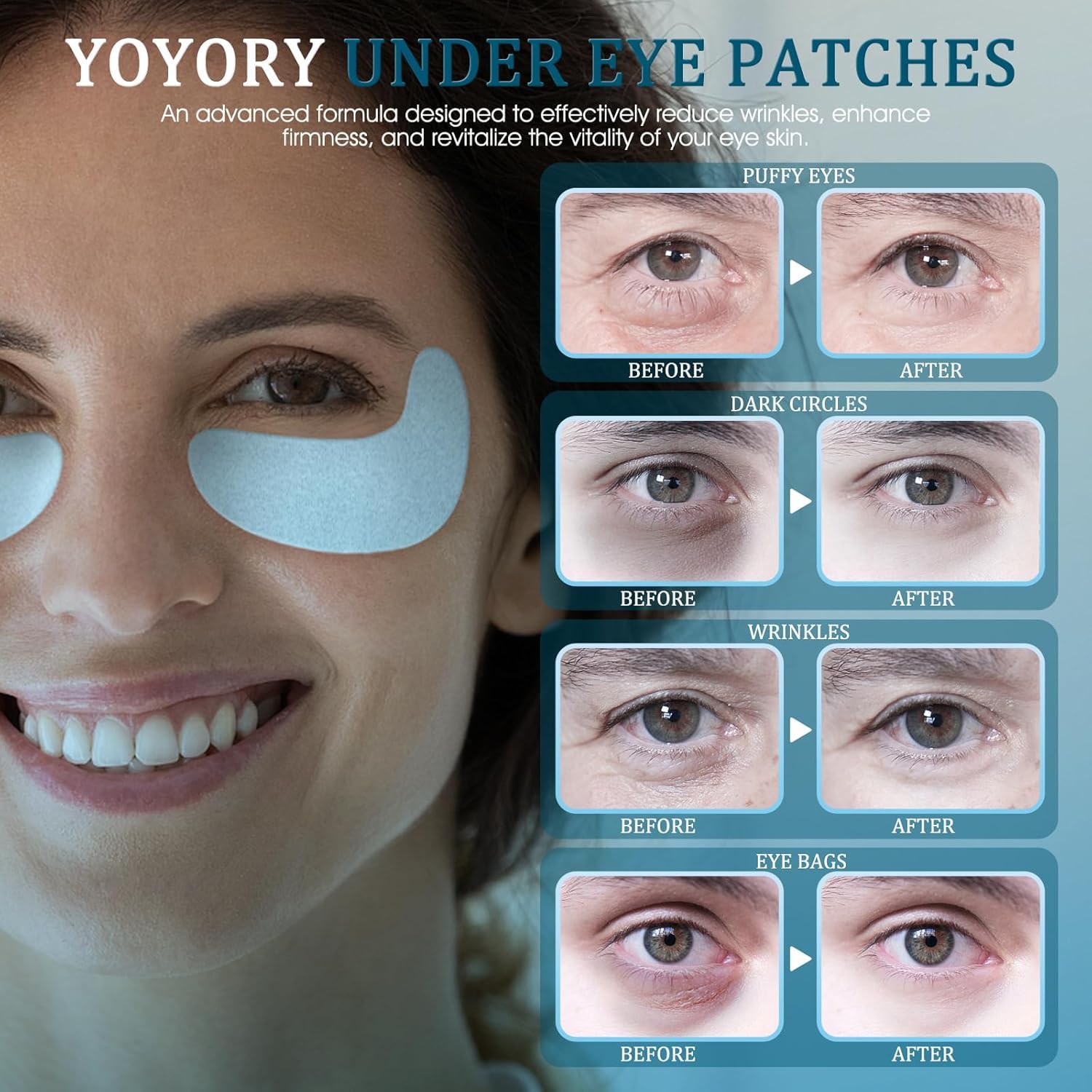 YOYORY Under Eye Patches Masks — Hydrating Hyaluronic Acid & Collagen (30 Pcs)