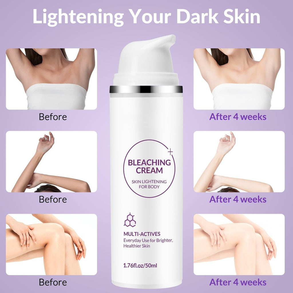 YTDB Skin Bleaching Cream – Lightweight, Moisturizing Dark Spot Remover for Body, Elbows, Knees & Intimate Areas (1.76 fl oz)