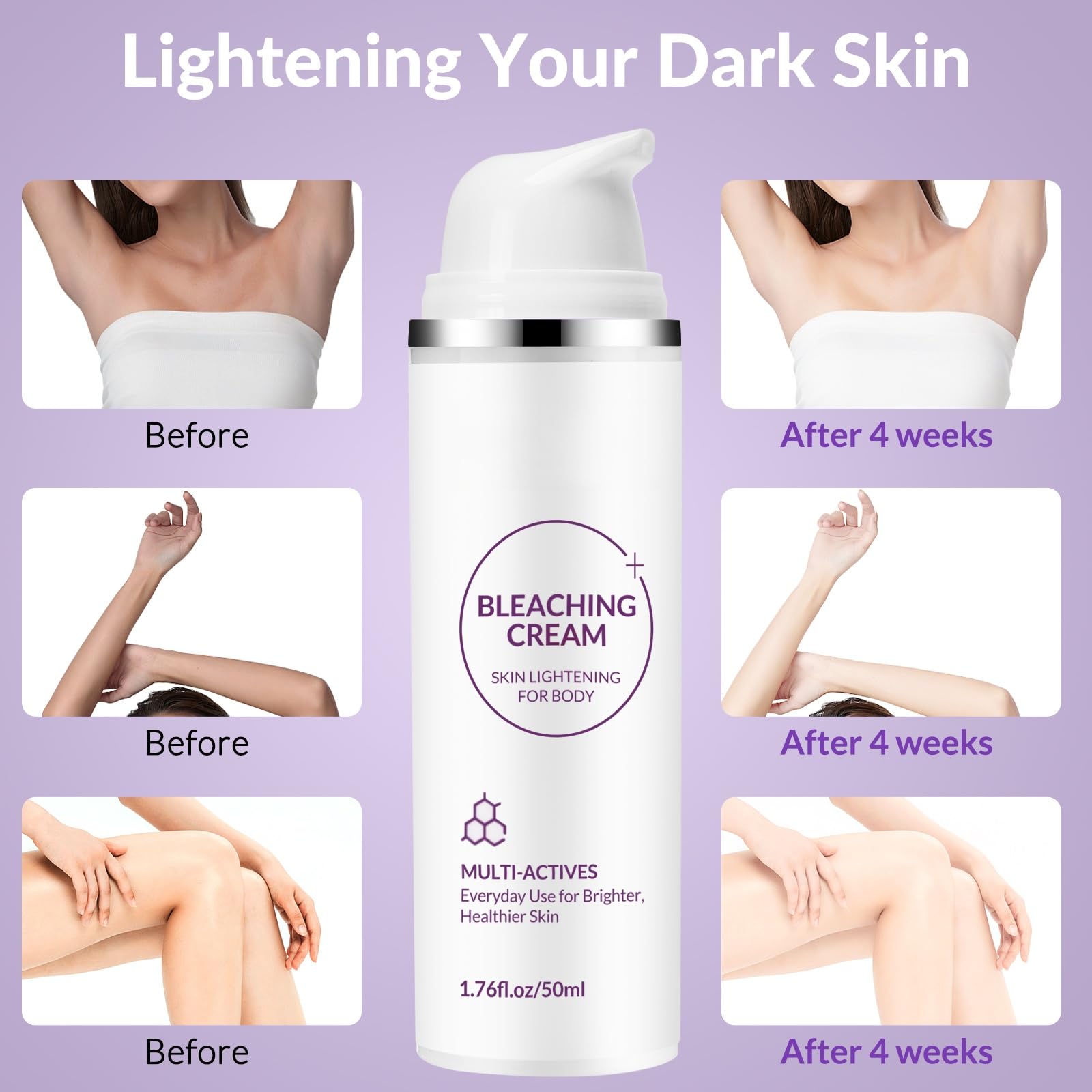 YTDB Skin Bleaching Cream – Lightweight, Moisturizing Dark Spot Remover for Body, Elbows, Knees & Intimate Areas (1.76 fl oz)
