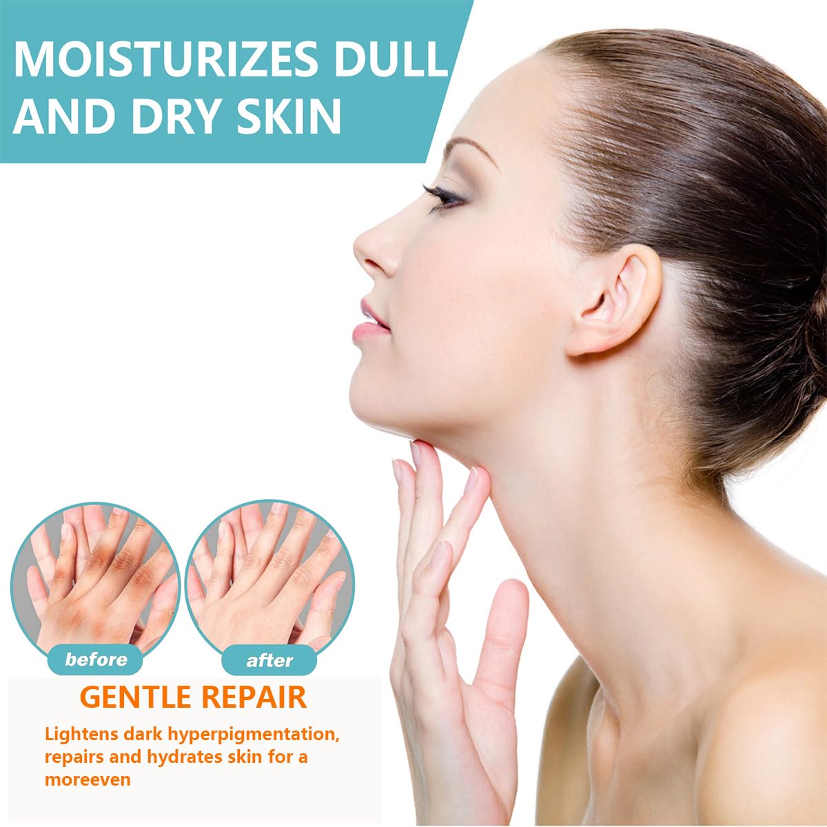 Yuehao Spot Remover for Body – Underarm & Neck (Acanthosis 3Box)