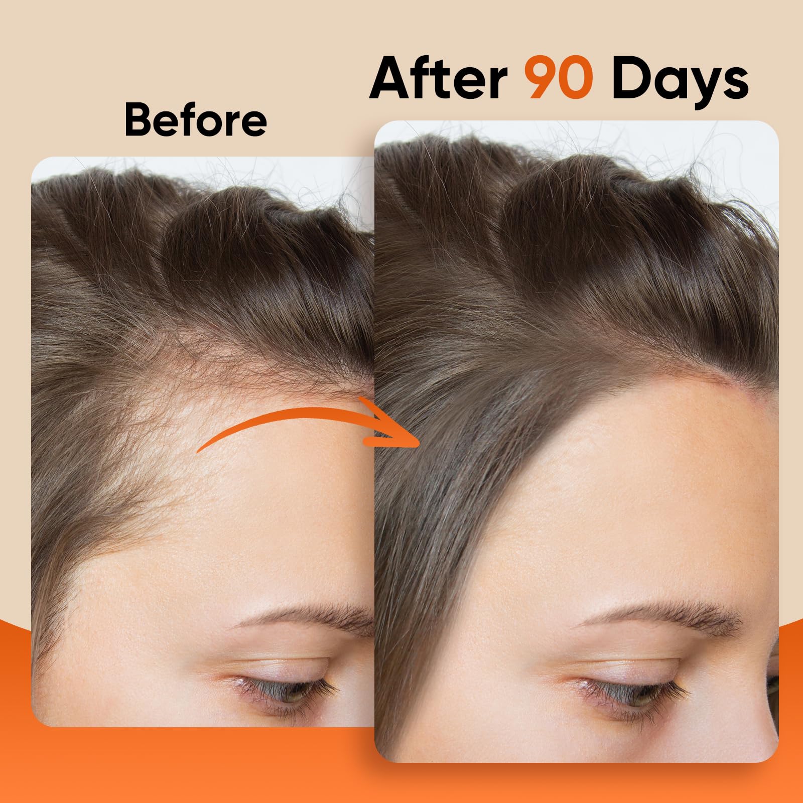 ZENTRIXA Batana Oil for Hair – 100% Raw, Cold-Pressed & Organic (8 oz)