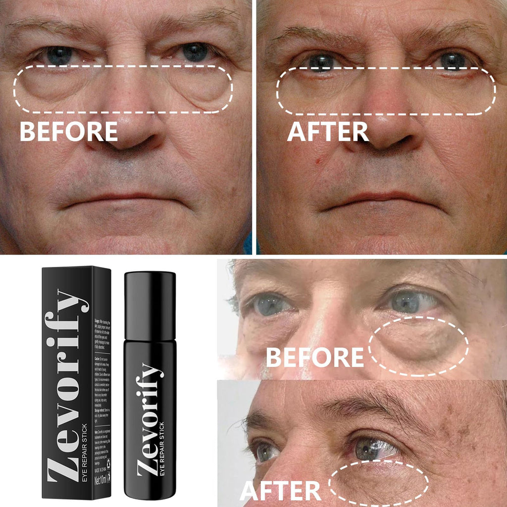 Zevorify Eye Repair Stick for Men | Caffeine Under-Eye Roller for Depuffing & Hydration | 0.34 Fl Oz
