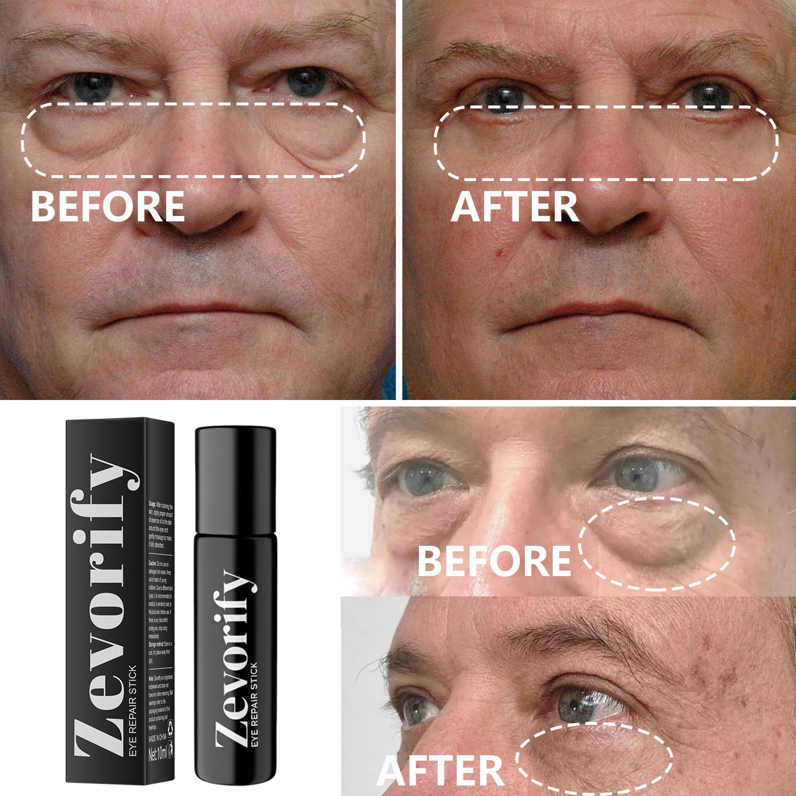 Zevorify Eye Repair Stick for Men | Caffeine Under-Eye Roller for Depuffing & Hydration | 0.34 Fl Oz