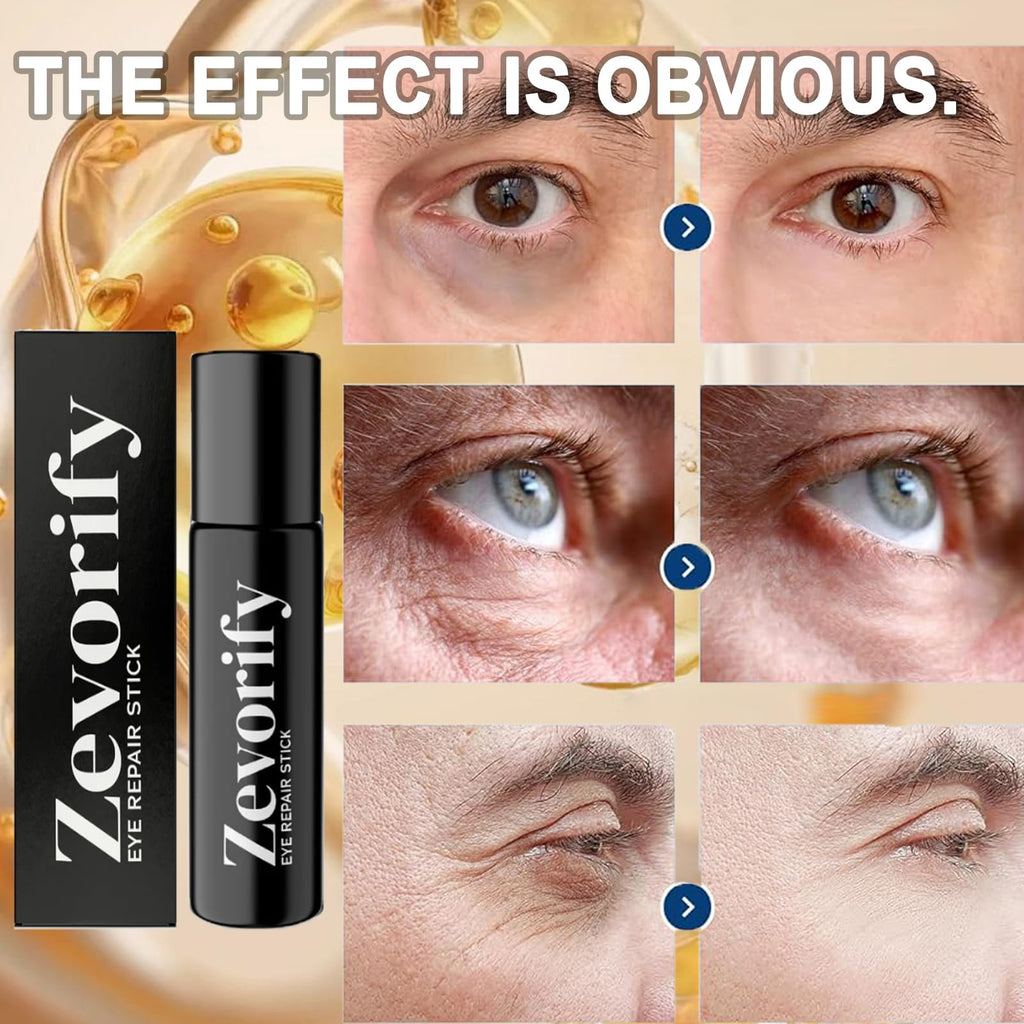 Zevorify Eye Repair Stick for Men | Cooling Under-Eye Roller, Depuff & Hydrate